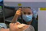 vision correction surgery image 1 vision correction surgery image 1